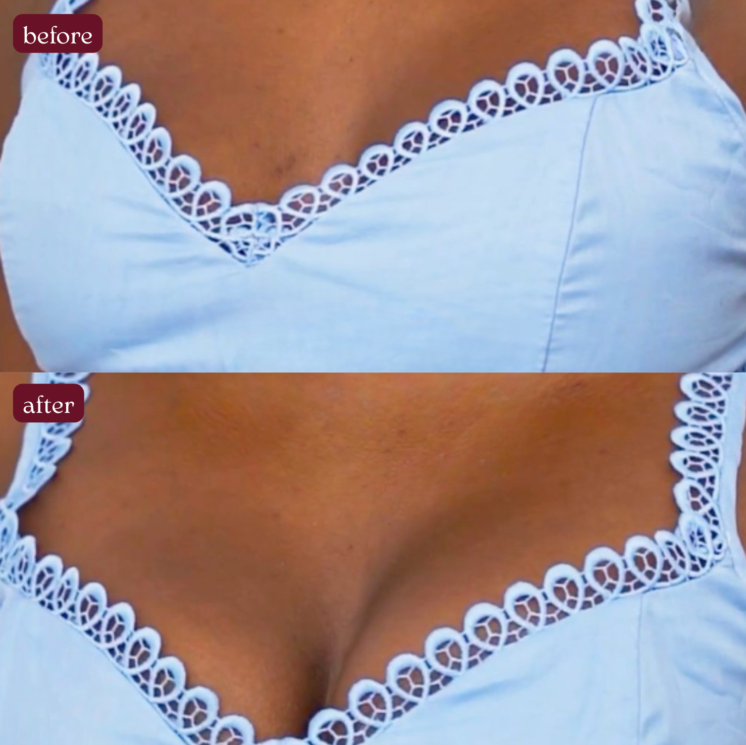 Magic Lift – Poppy© Strapless Adhesive Bra